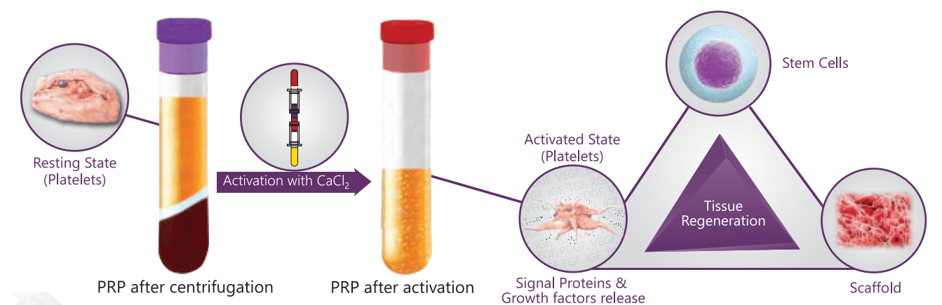 Schematic of activated PRP mode of action