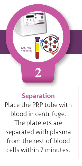 Step 2: Separation
