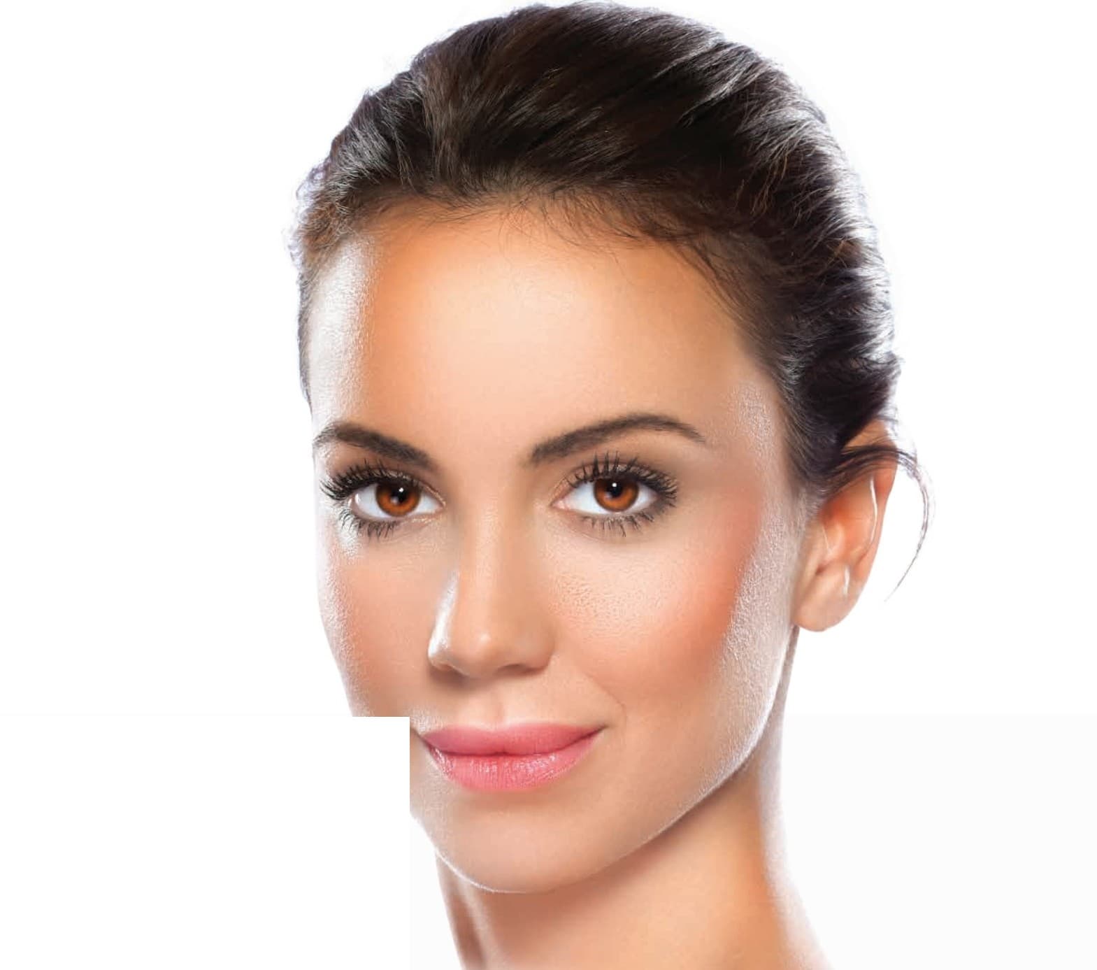 Natural, radiant skin achieved with Prizmah PRP therapy